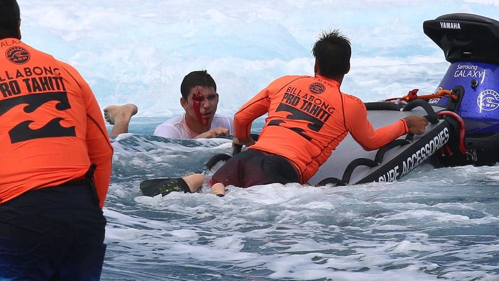 5 of the most gruesome surfer injured